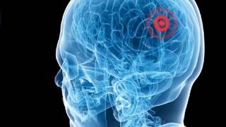 Yoav Medan: Ultrasound surgery -- healing without cuts