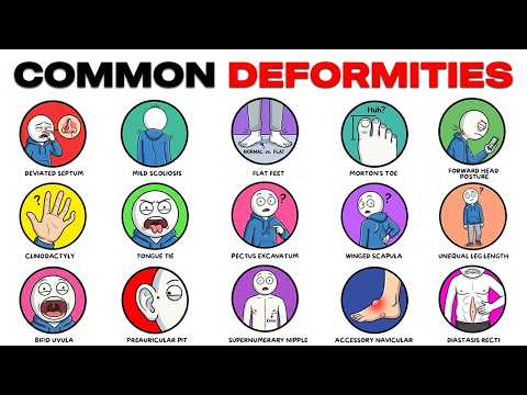 Common Deformities You Might Have Without Knowing