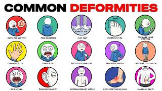 Common Deformities You Might Have Without Knowing