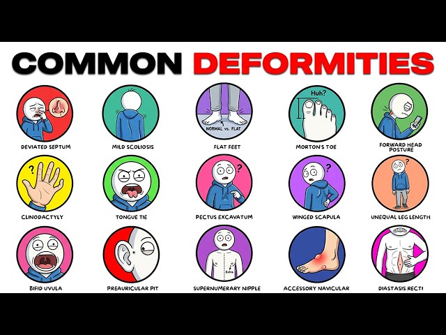 Common Deformities You Might Have Without Knowing