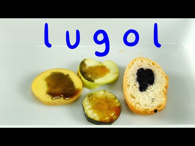 Videouttalande av Lugol Engelska