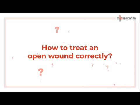 How to Treat an Open Wound Correctly? | Medanta