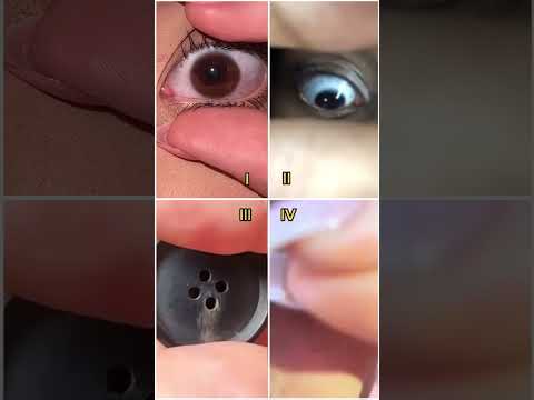 Who is the best? #248