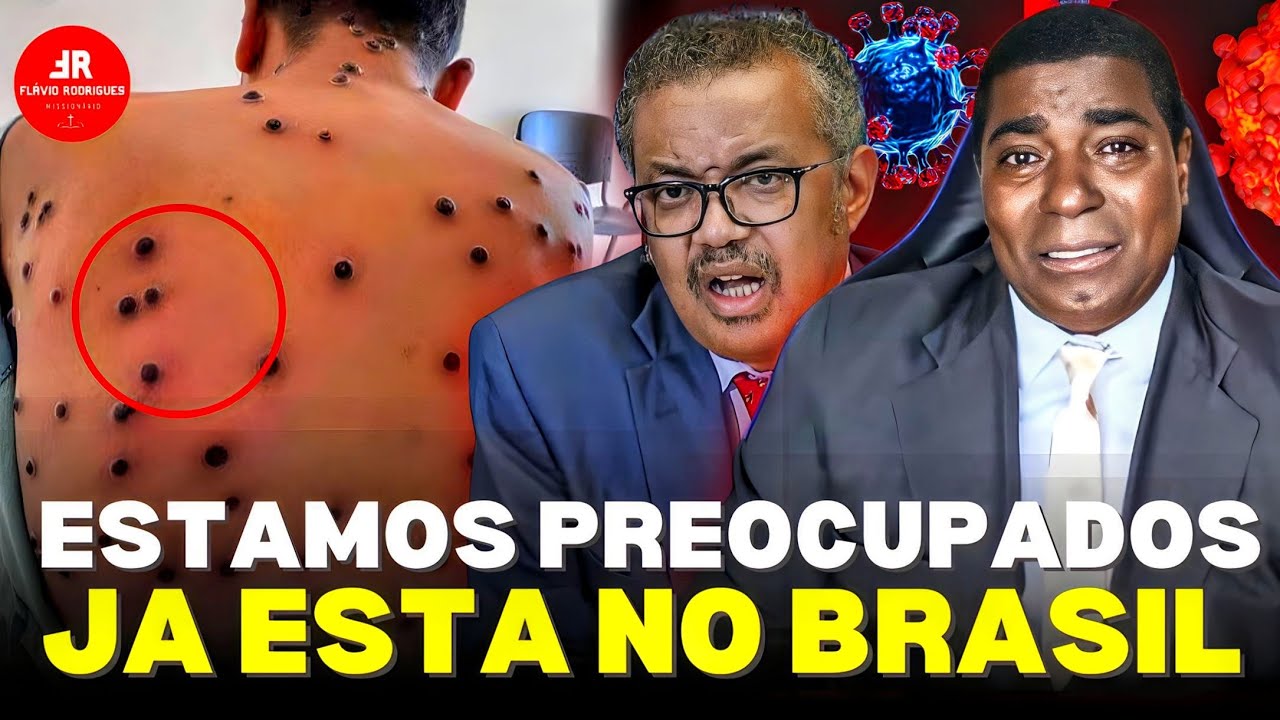 URG€NTE! Acaba De ACONTECER Isso, Já Está Se Espalhando Essa PR4GA No Brasil E NO Mundo, OREMOS