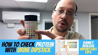 Urine Test For Kidney Disease (Protein In Urine) At Home Kidney Test. How To Use Urine Test Strips?