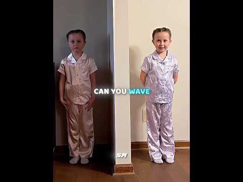 These Twins Are Sharing The Same Brain 😳