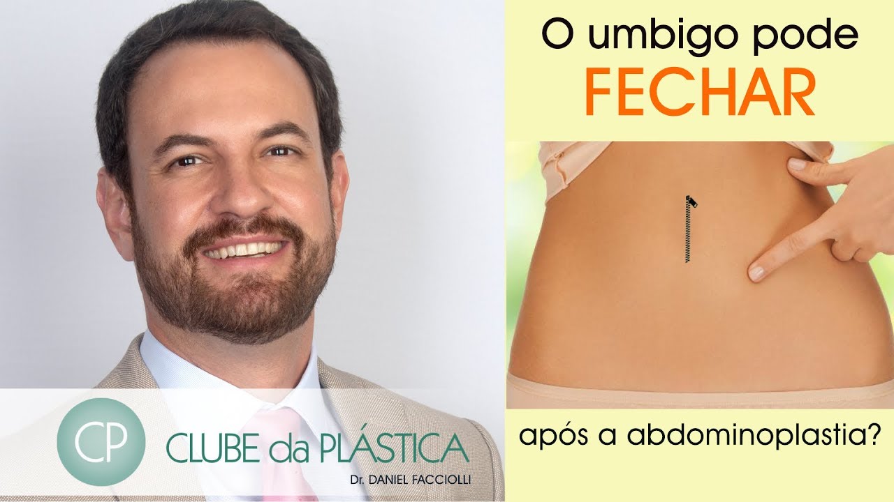 Clube da Plástica: O umbigo pode fechar após uma abdominoplastia