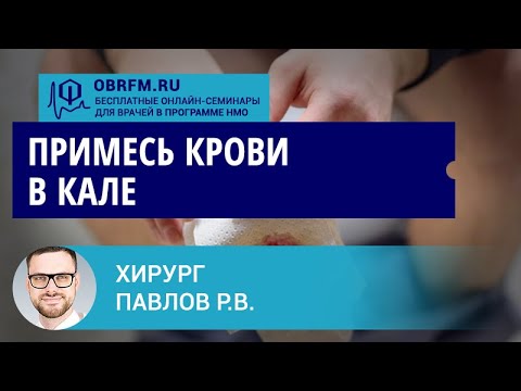 Хирург-онколог Павлов Р.В.: Примесь крови в кале