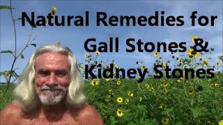 Natural Remedies for Gall Stones & Kidney Stones