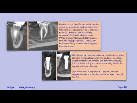 Anatomic radiology of mandible