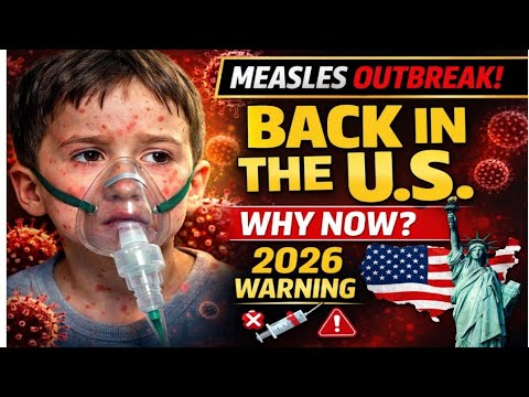 Measles Comeback 2026: The Shocking Rise in U.S. Cases Explained