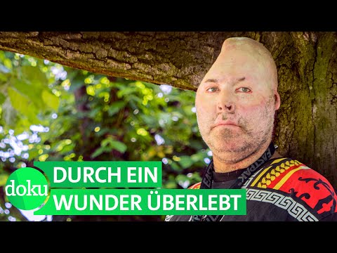 Niko fängt neu an: Schwerbehindert nach Explosion (Dr. Knarf) | WDR Doku