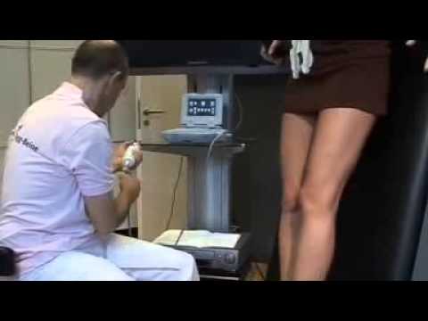 Prostatakrebs Saft Prostata-Operationsschaltung