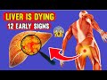LIVER is DYING! 12 Weird Signs of Liver Damage