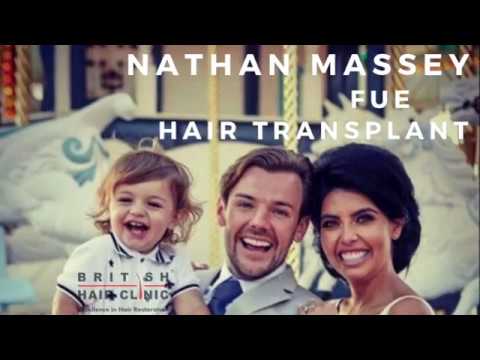 CELEBRITY Hair Transplant - Nathan Massey at The British Hair Clinic