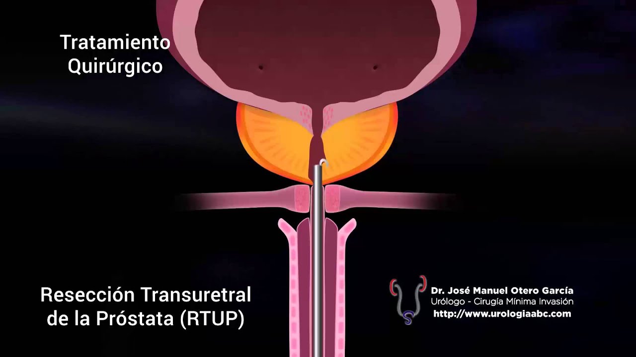 José Manuel Otero García-32