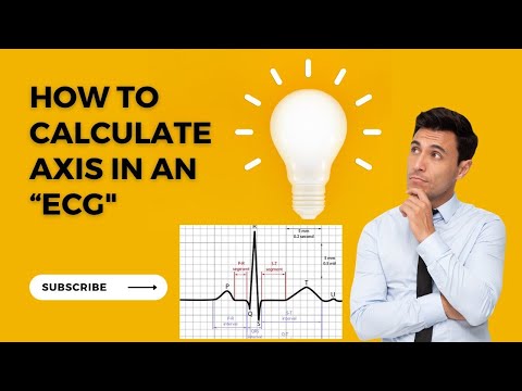 How to determine "AXIS" in an ECG?