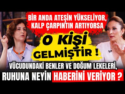 If Your Fever Rises and Your Heart Palpitations Increase,IT HASCOME What Do Moles and Spots Indicate