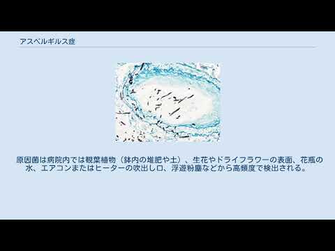 ネクトフリノイデス・アスペルギニス