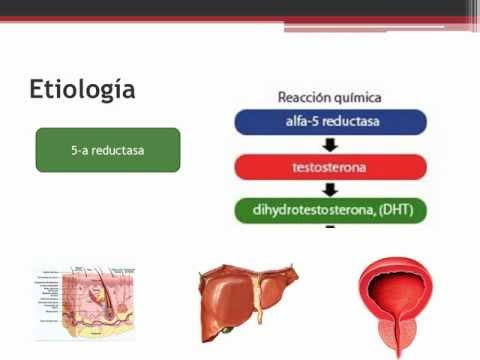 Mavit per trattare prostatite e adenoma BPH si verifica loperazione