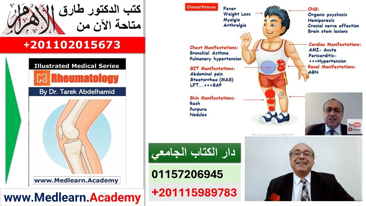 Polyarteritis Nodose (PAN) #cme #internal_medicine  #usmle #medicalschool   #medical #محاضرات_باطنة