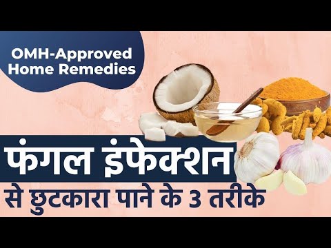 फंगल इंफेक्शन से छुटकारा पाने के 3 तरीके | Fungal Infection Home Remedies