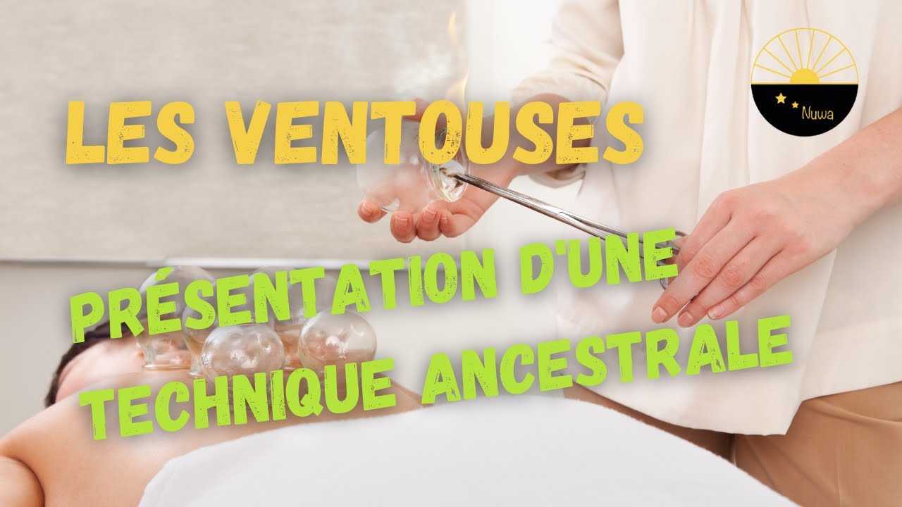Watch video Les ventouses en médecine traditionnelle chinoise Les ventouses en médecine traditionnelle chinoise