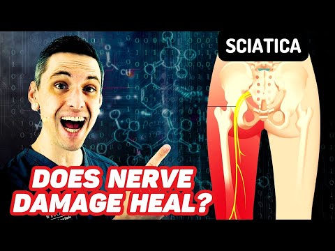 Does Sciatica Ever Heal? Nerve Damage Recovery