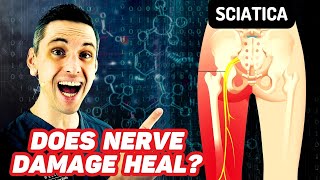 Does Sciatica Ever Heal? Nerve Damage Recovery