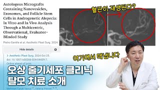 줄기세포 후기