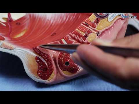 Anatomy of Perineum for Perineal repair