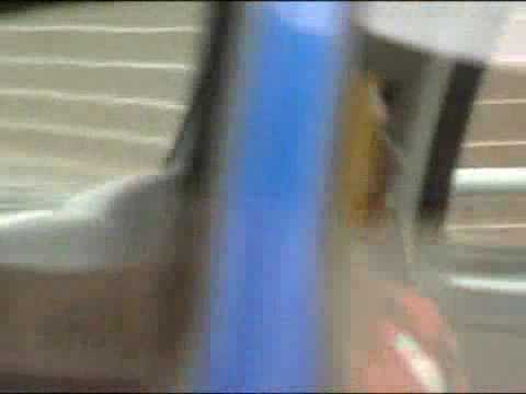 Xabi Alonso Having A Medical At Real Madrid (05-08-09)