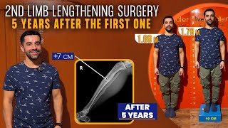 FIVE YEARS AFTER THE FIRST LIMB LENGTHENING SURGERY, HE DECIDED TO DO A SECOND SURGERY