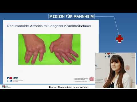 Rheuma kann jeden treffen... Im mittleren bis hohen Alter: klassisches Gelenkrheuma