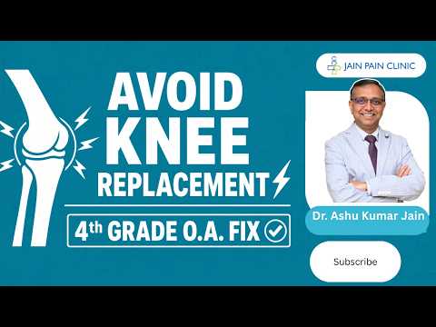 Watch video on Knee Joint Cooled RFA