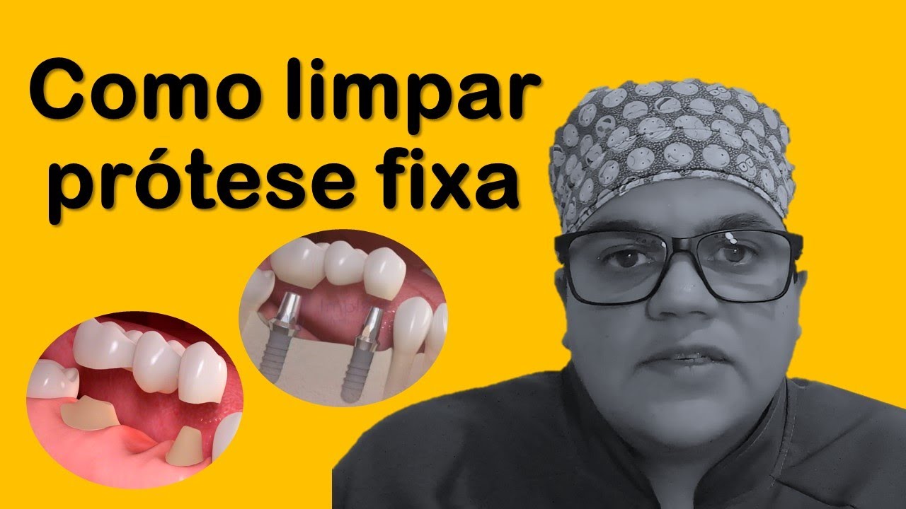 Como limpar prótese fixa | Dra Bianca Rosa