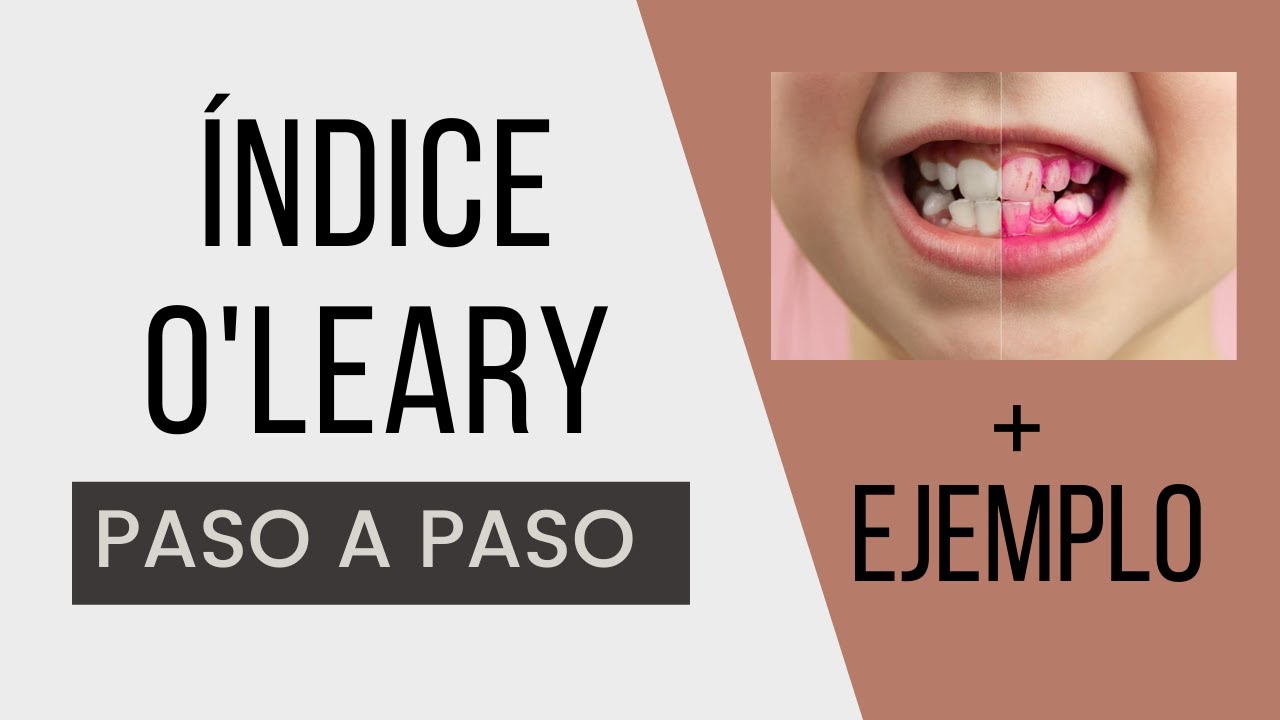 O'Leary Index Step by Step | Critical Dentistry