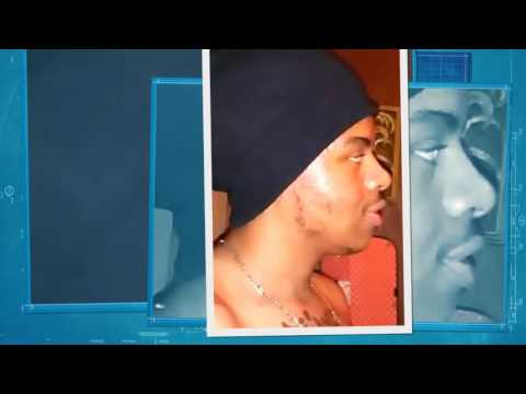 Let me be  By Vmyr DvppvTree(Amyr)