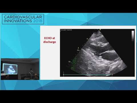 CVI2018 Coronary Challenging Case Competition: Semifinals 1 - Ioannis Paizis