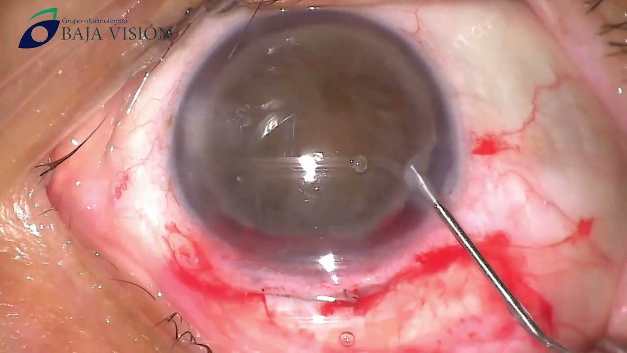 Isaac Mauricio Zúñiga González-5