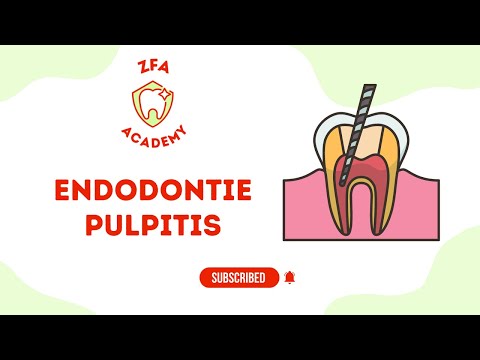 ZFA ACADEMY – Endodontie Basics: Was ist eine Pulpitis? | Fit für die Prüfung!