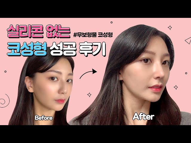 코재수술비용 합리적인 2