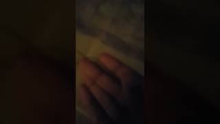 My 6th tooth came out.