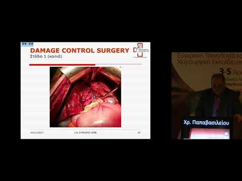 Χρ Παπαβασιλείου - Χειρουργική αρχικού ελέγχου της βλάβης Damage Control Surgery