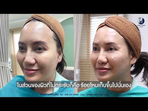 รีวิวโปรแกรมปรับรูปหน้าแบบองค์รวม