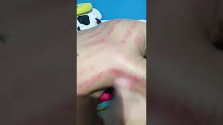 Download lagu cah ndeso kerokan punggung serta leher masuk angin bikin plong mp3 Download lagu cah ndeso kerokan punggung serta leher masuk angin bikin plong mp3