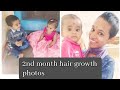 After Headshave Hair Growth Photos 2nd Month And Rakshabandhan Photos Aparna S Lifestyle