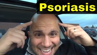 How To Treat Psoriasis On Scalp-Easy Natural Remedies