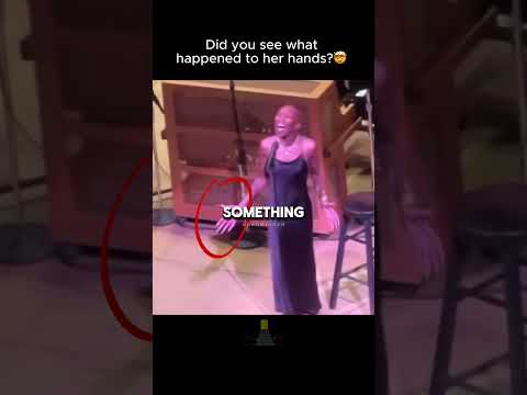 Watch Her Hands Closely 👀