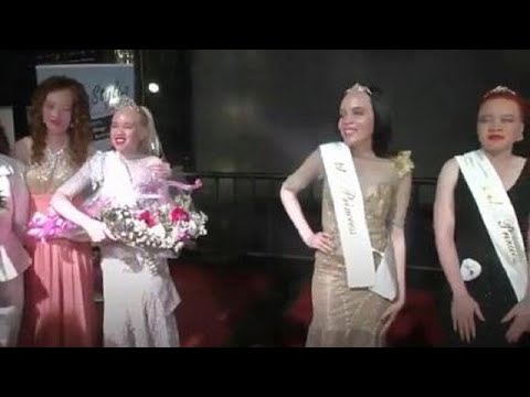 Zimbabwe crowns its first 'Miss Albino' with $85 prize money